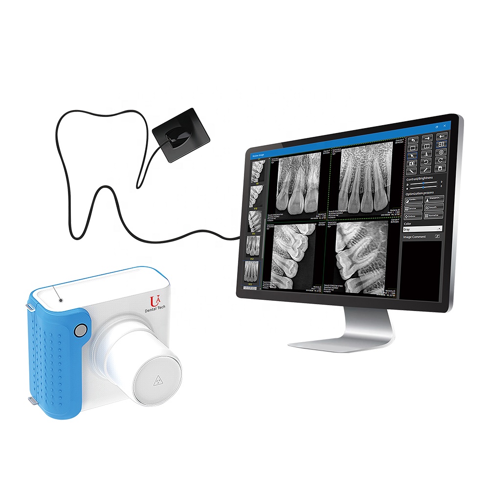 System obrazowania rentgenowsk – Veterinary X-Ray recenzja i cena
