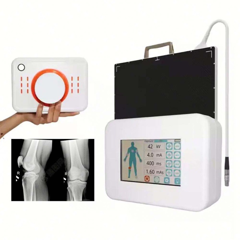 Przenośny, mały, ręczny, cyfro – Veterinary X-Ray recenzja i cena